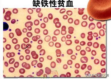 什么时候需要补硒呢(补硒需要天天补吗)-硒宝网