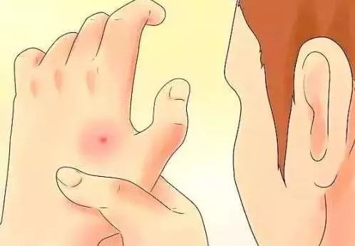 妇科炎症补硒管用么(妇科炎症吃硒有用吗)-硒宝网