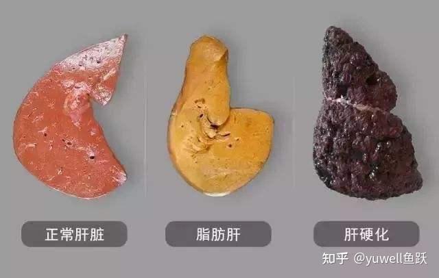 脂肪肝每天补硒多少(每天肝脂肪补硒多少)-硒宝网