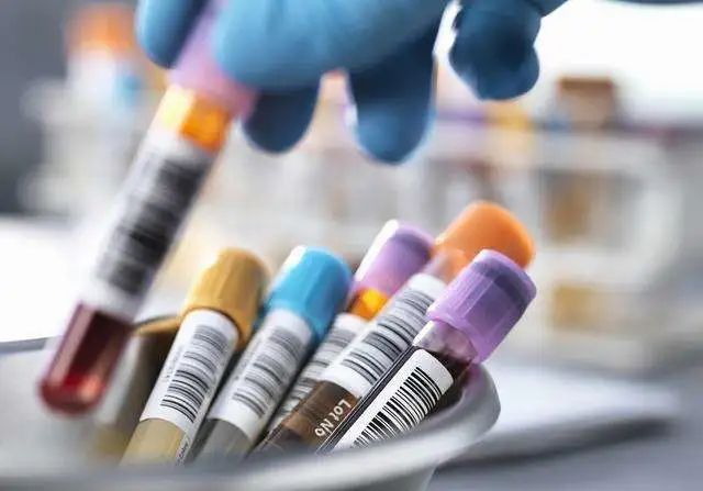 补硒会引起尿潜血吗(尿隐血和尿潜血一样吗)-硒宝网