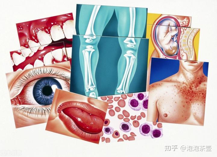 补钙最快的方法(补钙方法有哪些)-硒宝网