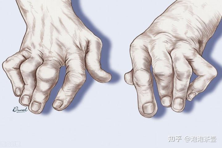 补钙最快的方法(补钙方法有哪些)-硒宝网