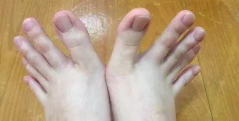 补硒可以喝桂花茶吗（硒片喝茶水可以一起服用吗）-硒宝网