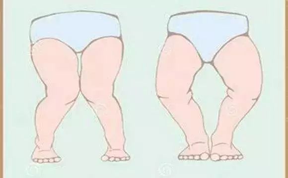 6岁孩子补钙哪种钙好（给孩子补钙哪种钙好吸收）-硒宝网