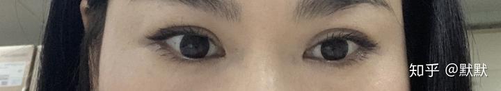 医院有没有补硒的药(有没有补硒的药品不是保健品)-硒宝网