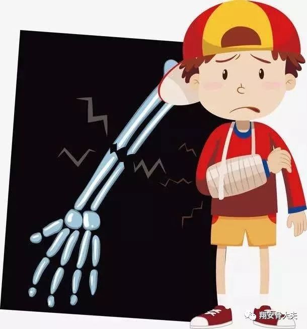 骨折了能吃硒来补吗（骨折能吃补药吗）-硒宝网