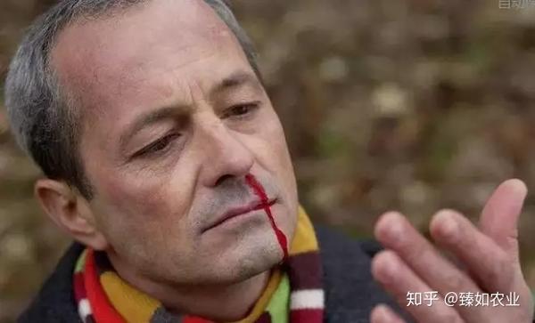 长期补硒导致血压高（补硒对高血压有啥好处）-硒宝网