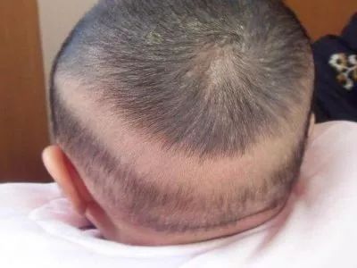 婴儿几个月开始补钙(婴儿钙需要补到几个月)-硒宝网