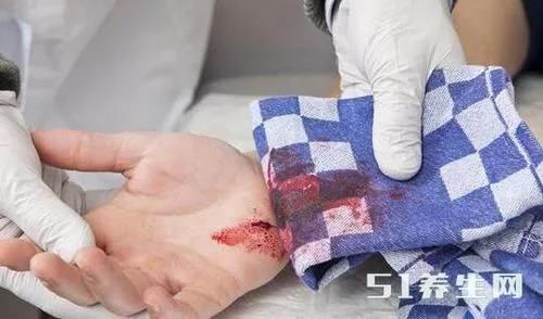 身体补硒为何脸会肿（补硒会使皮肤发黄吗）-硒宝网