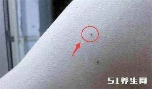 身体补硒为何脸会肿（补硒会使皮肤发黄吗）-硒宝网