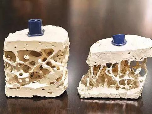 50岁左右补钙吃哪种好（优先补钙片）-硒宝网