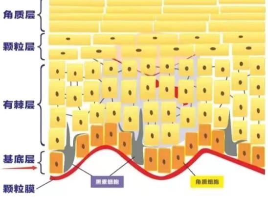 补硒可以去除色斑吗（去除色斑补硒可以吗）-硒宝网