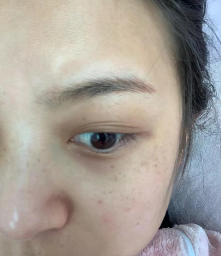 补硒可以去除色斑吗（去除色斑补硒可以吗）-硒宝网