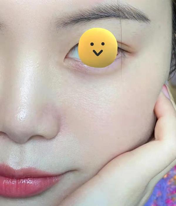 补硒可以去除色斑吗（去除色斑补硒可以吗）-硒宝网