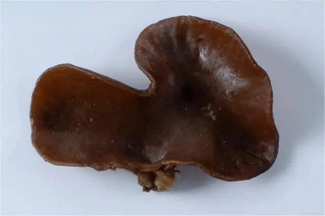 补硒可以去除色斑吗（补硒能祛斑吗）-硒宝网