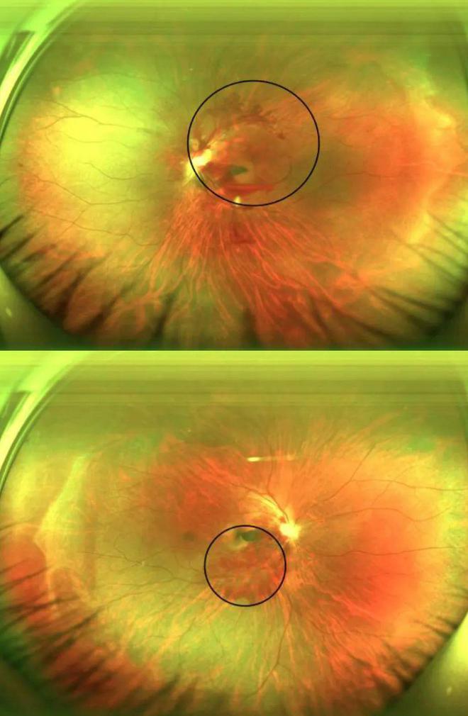 增进抗龋齿能力的最主要微量元素是（抵抗龋齿的微量元素）-硒宝网