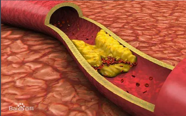 补硒对身体有何影响（补硒会影响睡眠吗）-硒宝网