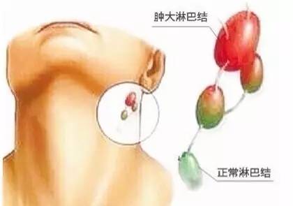 补硒会影响长痘痘吗(痘痘补长影响硒会吸收吗)-硒宝网