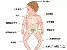 吃a d还用补硒吗（口服补硒药）-硒宝网