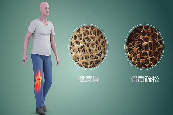 骨头补钙吗(排骨补钙还是大骨头补钙)-硒宝网