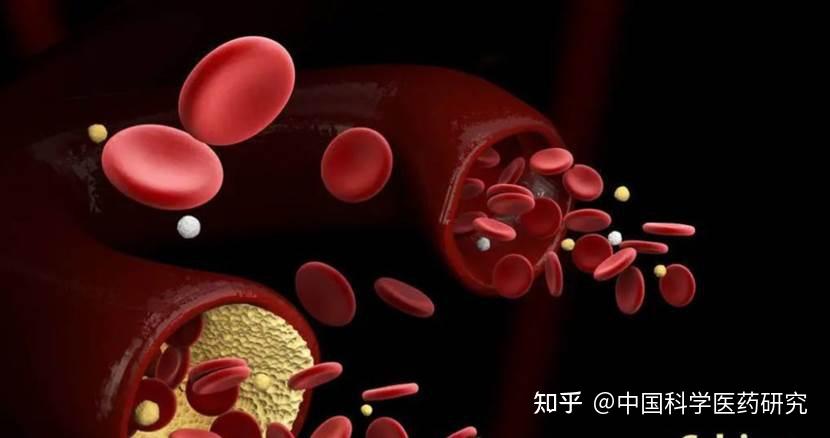 中老年人补钙吃什么钙片好（中老年人吃钙片有什么好处）-硒宝网