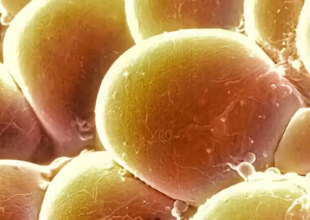 肝硬化患者可补硒吗（肝硬化可以吃硒酵母片吗）-硒宝网