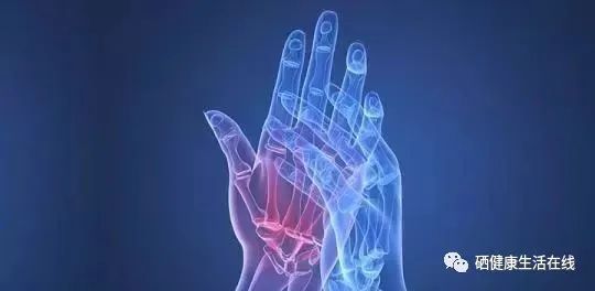 补硒可以改善类风湿（硒与风湿骨关节疾病的关系）-硒宝网