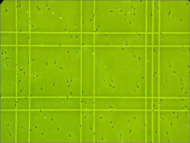 怀孕缺硒可以不补吗(孕期能补硒吗)-硒宝网