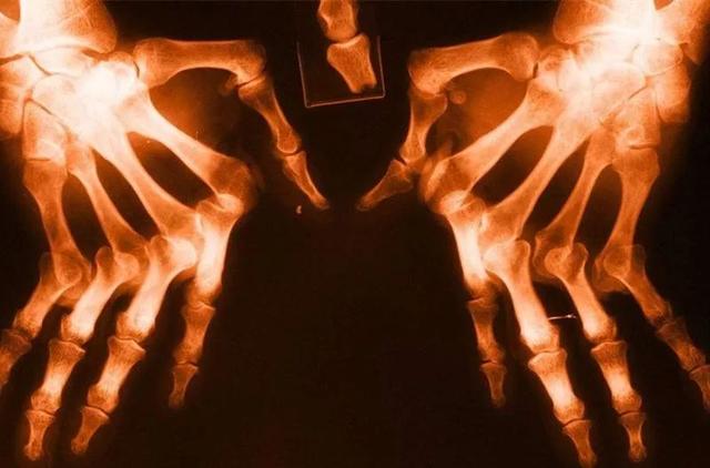 补硒对过敏有作用吗（硒有抗过敏的作用吗）-硒宝网