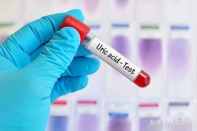 尿酸高男性能补硒吗（尿酸高吃硒行吗）-硒宝网