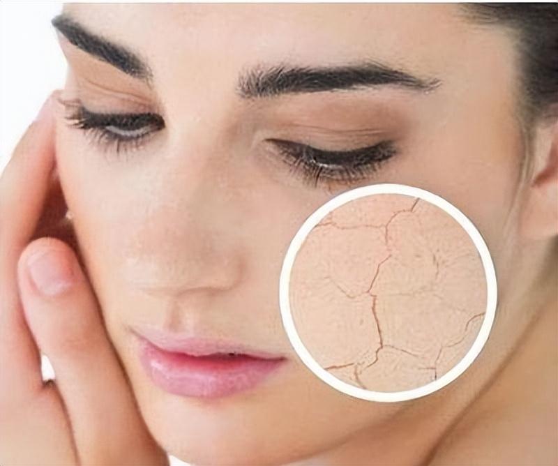 女性补硒会晚绝经吗(绝经后补充雌激素会来月经吗)-硒宝网