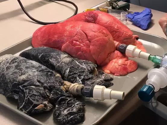 补硒对吸烟有作用吗(补硒对吸烟喝酒的作用)-硒宝网