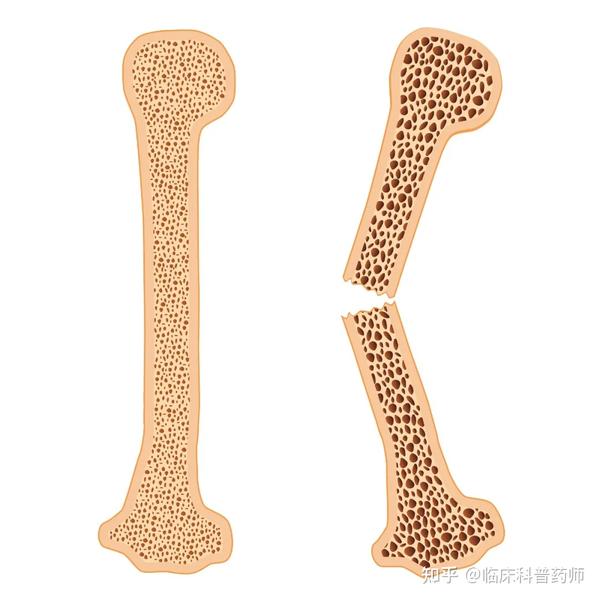 补钙维生素d(维生素补钙的d3什么牌子好)-硒宝网