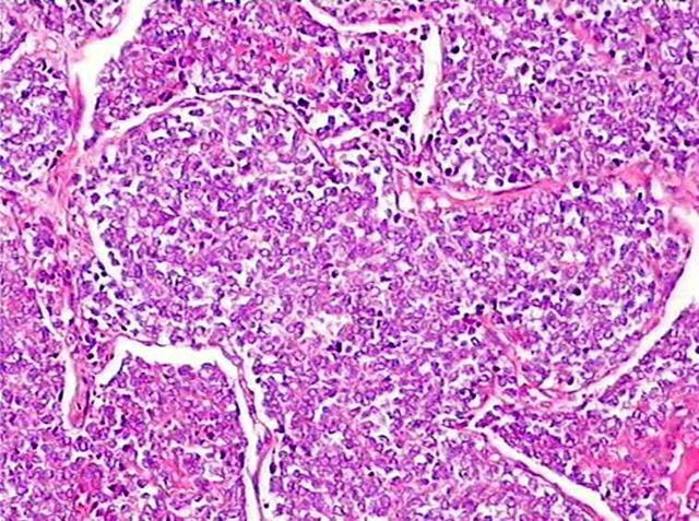 老年人如何科学补硒(老年人补硒的重要性)-硒宝网