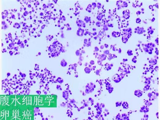 老年人如何科学补硒(老年人补硒的重要性)-硒宝网