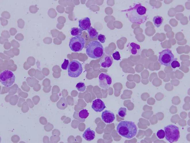 什么食物能补锌（食物补锌有哪些食物是最好）-硒宝网