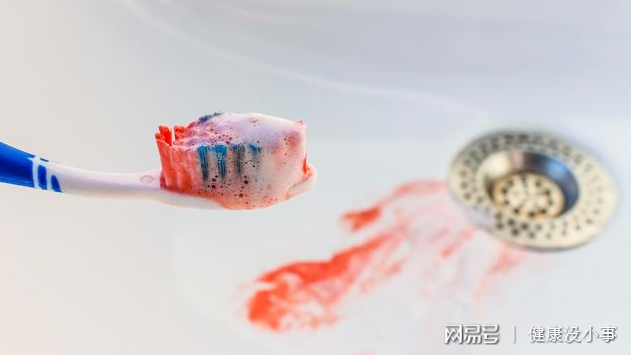 补硒治疗静脉曲张吗(硒与静脉曲张关系)-硒宝网