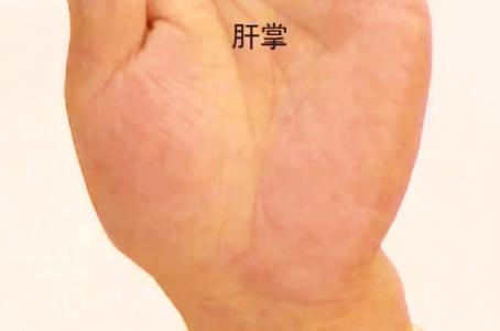 补硒治疗静脉曲张吗(硒对静脉曲张有效果吗)-硒宝网