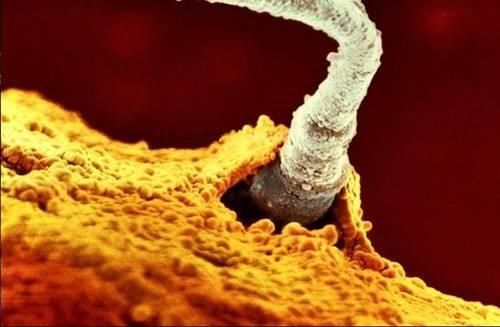 备孕期间需要补硒吗（备孕期间能吃补硒的保健品吗）-硒宝网