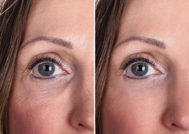 为什么晒太阳补钙(晒太阳补钙需要直晒太阳吗)-硒宝网