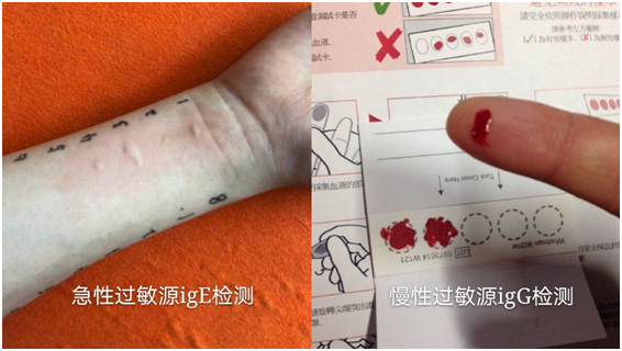 补硒会不会引起过敏（硒与过敏体质）-硒宝网