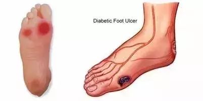 补硒能提高白蛋白吗(蛋白能补白提高硒含量吗)-硒宝网