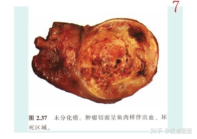 孕期甲减可以补硒吗（孕期补硒甲减可以吃叶酸吗）-硒宝网