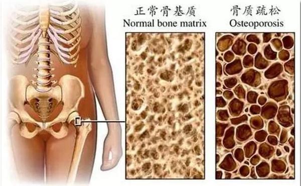 35岁需要补钙吗（补钙需要停一段时间吗）-硒宝网