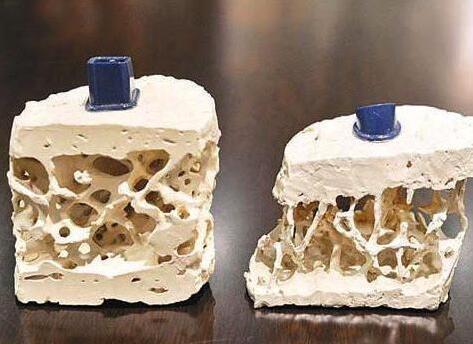 补钙吃钙片好还是喝牛奶好（补钙喝牛奶）-硒宝网