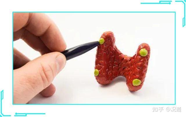 肾结石患者如何补钙(肾结石补钙患者吃什么)-硒宝网