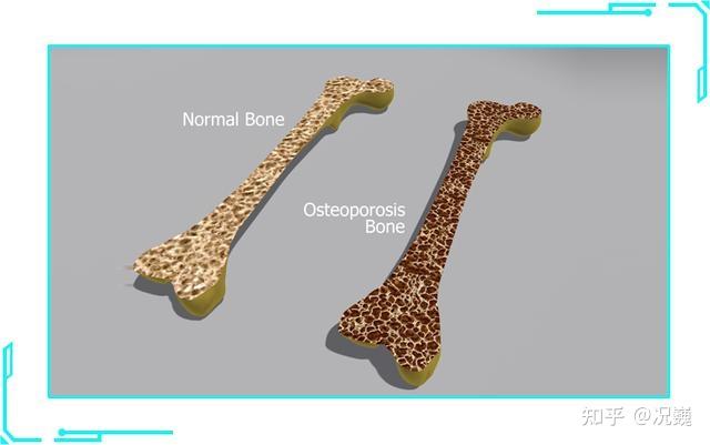 肾结石患者如何补钙(肾结石补钙患者吃什么)-硒宝网