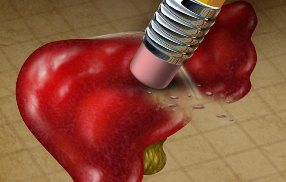 补硒对肝硬化的疗效(疗效肝硬化补硒有用吗)-硒宝网