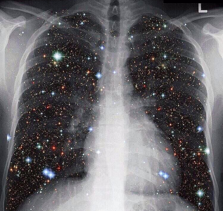 钛和硒可以同时补吗（钛和硒那个对癌好）-硒宝网