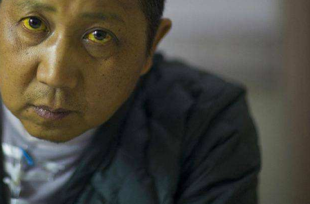 补硒过量与指甲竖纹（指甲竖纹补啥钙）-硒宝网